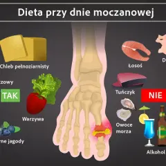 Dieta przy dnie moczanowej: TAK - nabiał niskotłuszczowy, chleb pełnoziarnisty, warzywa, wiśnie, czarne jagody. NIE - drób, łosoś, tuńczyk, czerwone mięso, podroby, owoce morza, alkohol.