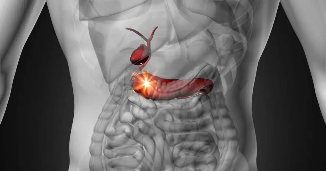 Anatomical illustration of the gallbladder and pancreas, with the pancreas highlighted in red and glowing.