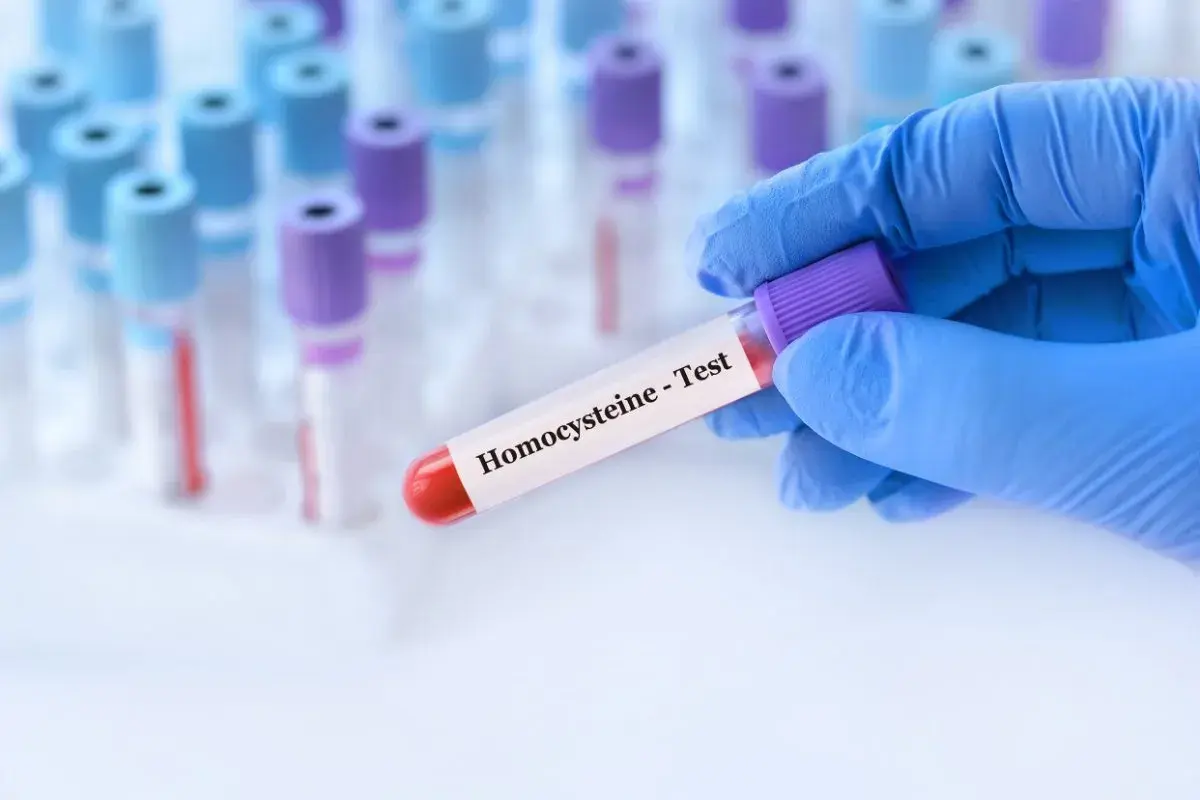 Ręka w niebieskiej rękawiczce trzyma probówkę z napisem "Homocysteine - Test".